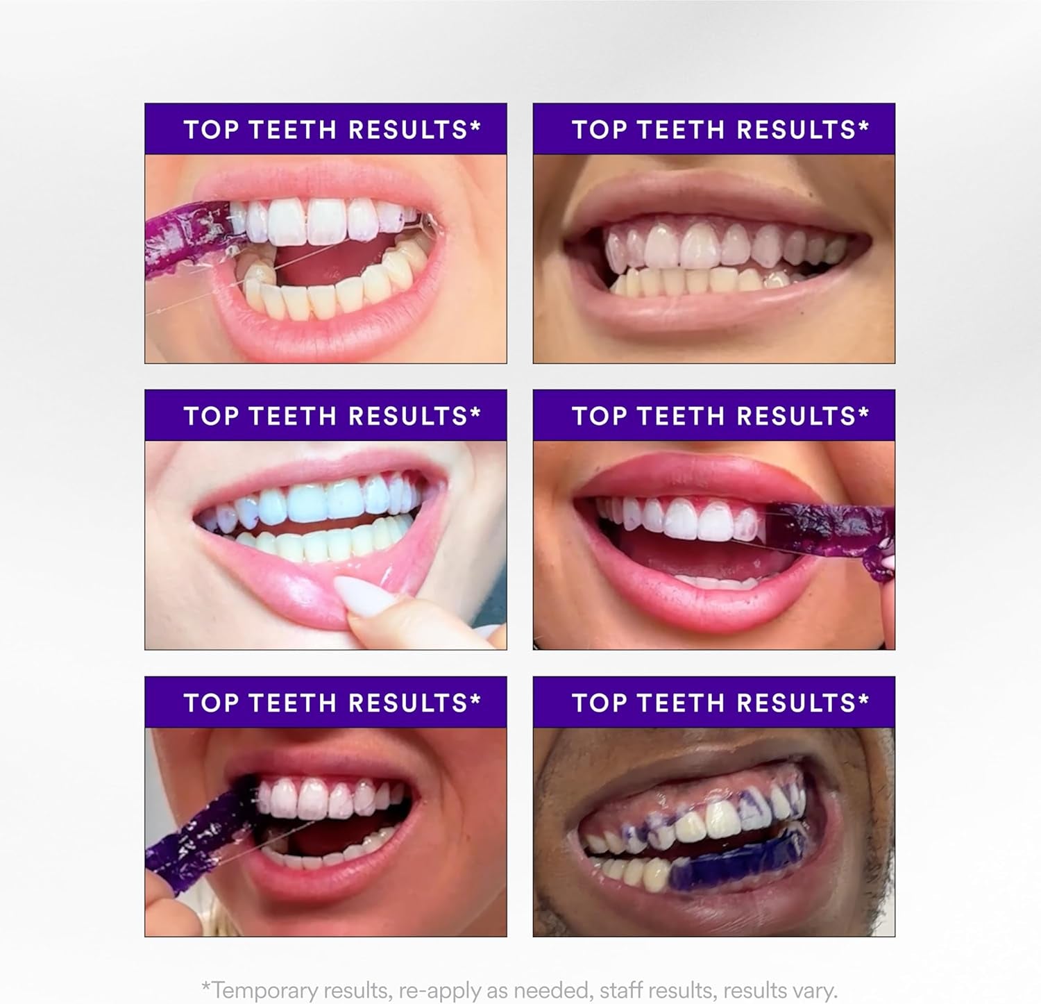 V34 Whitening Strips, Teeth Whitening Strips, Purple Tooth Whitening, Purple V34 Whitening Strips, Tooth Stain Treatment, Combining Whitening and Colour Correction
