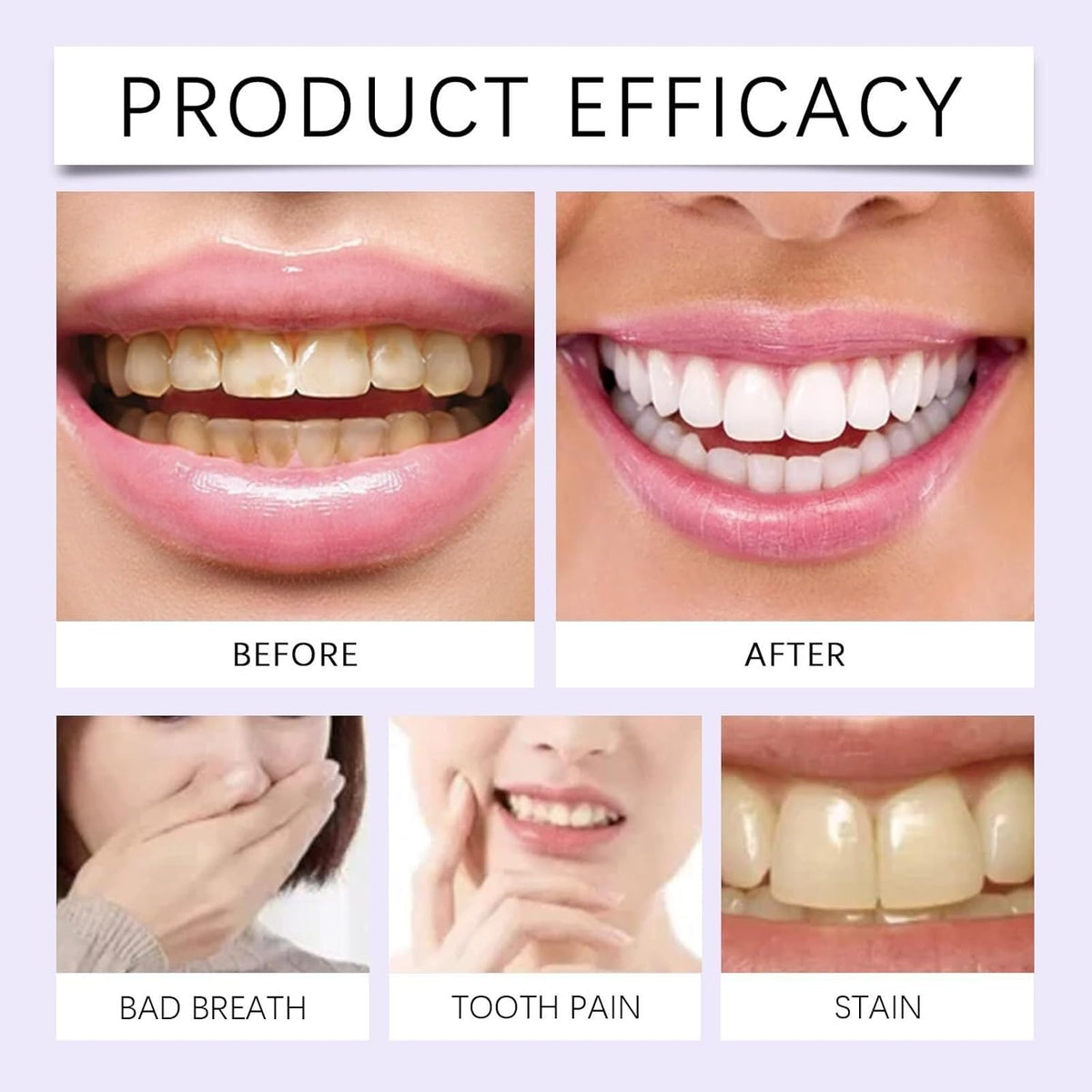 Purple Whitening Strips